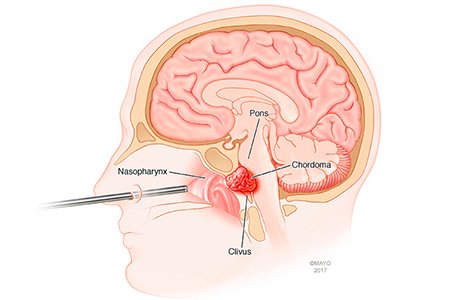 Ent Surgeon in vastrapur